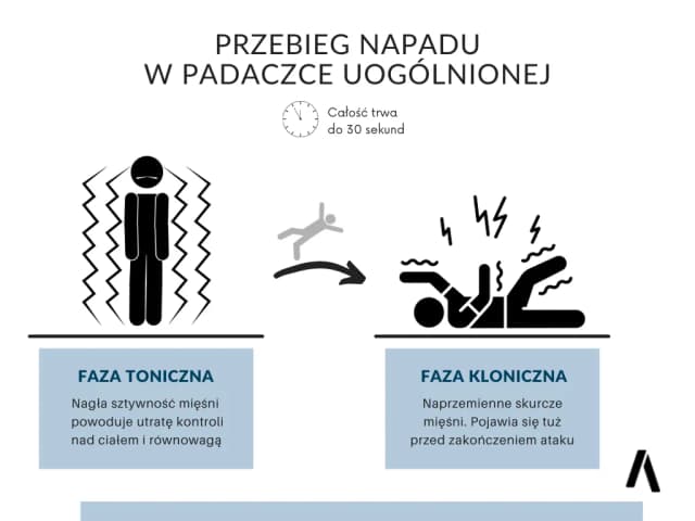Padaczka: objawy, pierwsza pomoc i kluczowe informacje, które ratują życie Padaczka: objawy, pierwsza pomoc i kluczowe informacje, które ratują życie