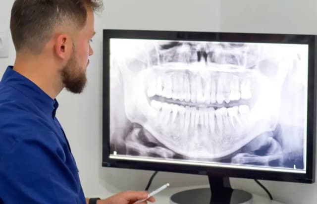 Czy pantomogram jest na NFZ? Sprawdź, co musisz wiedzieć, aby skorzystać Czy pantomogram jest na NFZ? Sprawdź, co musisz wiedzieć, aby skorzystać