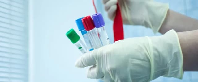 Czy badania hormonalne są na NFZ? Sprawdź, co musisz wiedzieć Czy badania hormonalne są na NFZ? Sprawdź, co musisz wiedzieć
